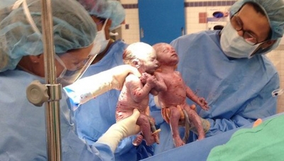 Lindën të kapura prej dore, ja sa janë rritur dy binjaket pas 4 viteve