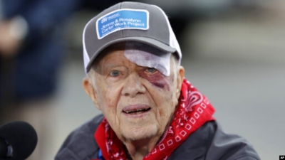 VOA: Ish-presidenti Jimmy Carter shtrohet në spital