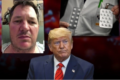 VIDEO/ Rrëfimi drithërues i pacientit me COVID-19: Si më shpëtoi jetën ilaçi që përmendi Trump