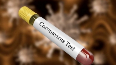Dy shtetet e vetme në Europë ku ende nuk ka ende raste me koronavirus