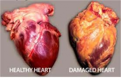 Video shokuese/ Ja çfarë i shkakton duhani zemrës