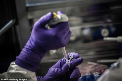 Australia gati një vaksinë për koronavirusin: Së shpejti do të testohet tek kafshët
