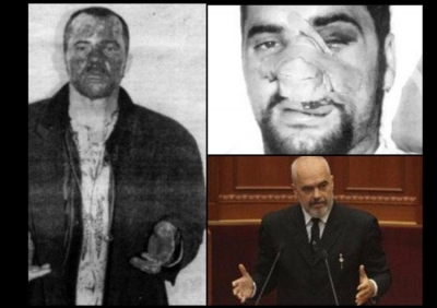 Sali Berisha paralajmëron Edi Ramën/Po e publikove prapë këtë foto, do bëj publike të vertetën