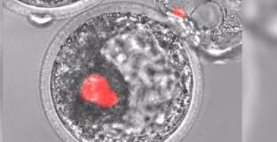Holandë/ Krijohet embrioni i parë artificial