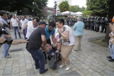 Sulmet e policisë, qytetarë të plagosur në Shkodër