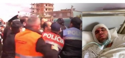 VIDEO/ FNSH i zbrazi dy bombula me gaz, humbi ndjenjat, banori i Astirit flet nga spitali