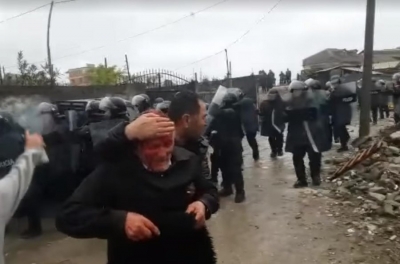 I goditur në kokë nga policia, 76-vjeçari përfundon në Spitalin e Traumës