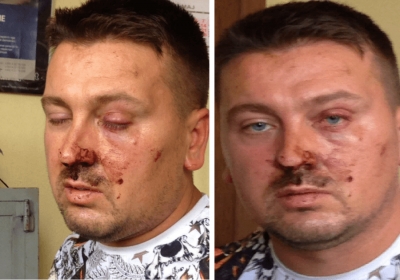 Të shtënat me armë ndaj banesës, zbardhet dëshmia e Kullës