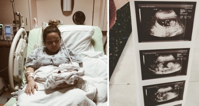 Nëna përjeton tmerr gjatë lindjes, mjekut i bie foshnja nga dora