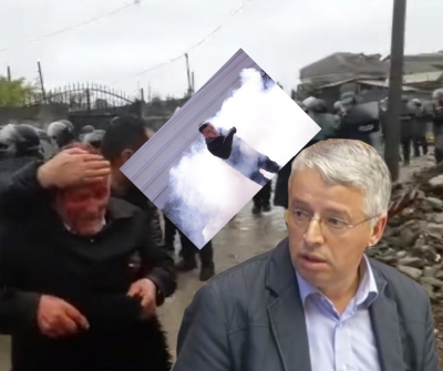 Lleshaj, gaz dhe kërbaç