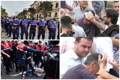 Kokë të çarë e fraktura në trup, si u gjakosën e dhunuan barbarisht protestuesit nga policia.