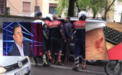 FOTO/ Policia plagos Nikoll Lesin